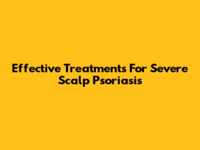 Effective Treatments For Severe Scalp Psoriasis