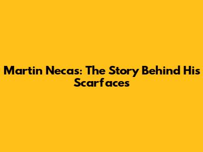 Martin Necas: The Story Behind His Scarfaces