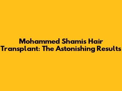 Mohammed Shami's Hair Transplant: The Astonishing Results