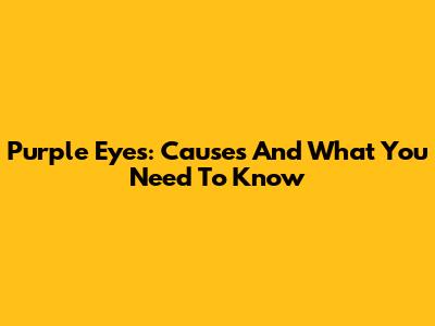 Purple Eyes: Causes And What You Need To Know