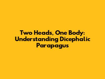 Two Heads, One Body: Understanding Dicephalic Parapagus