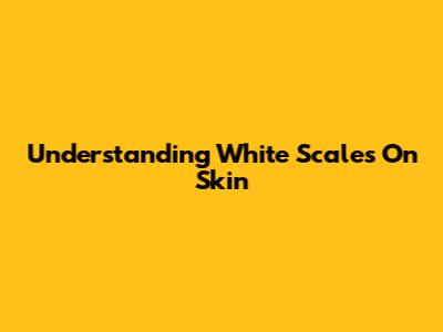 Understanding White Scales On Skin